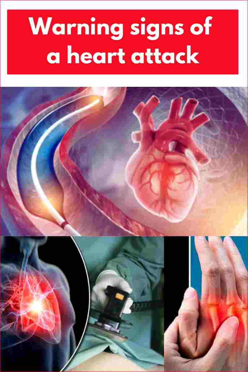 Warning signs of a heart attack