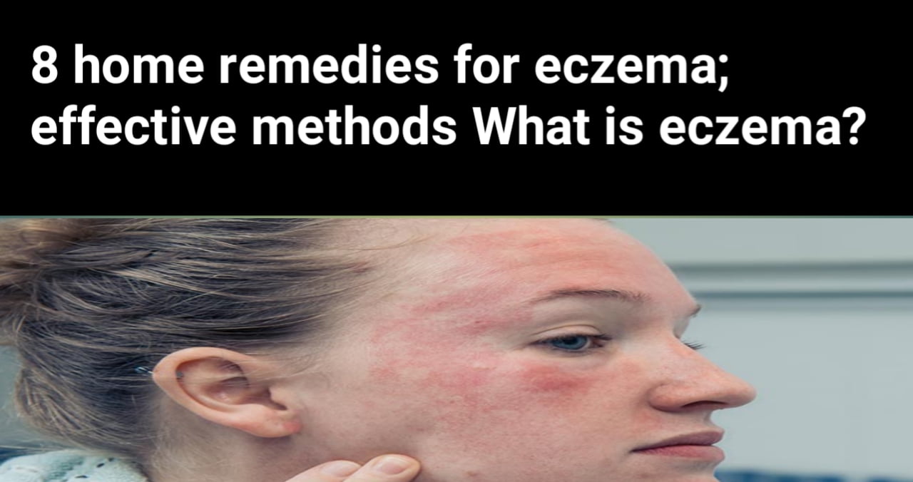 8 home remedies for eczema effective methods What is eczema