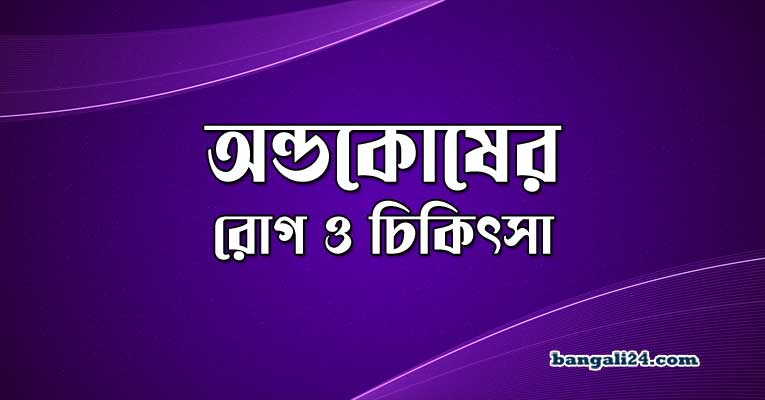 অন্ডকোষের রোগ ও চিকিৎসা