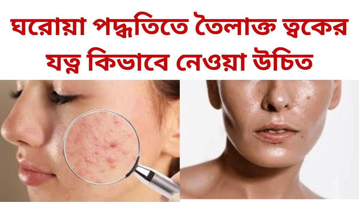 ঘরোয়া পদ্ধতিতে তৈলাক্ত ত্বকের যত্ন কিভাবে নেওয়া উচিত